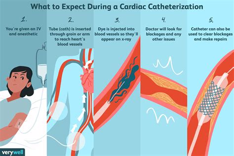 Cardiac Catheterization Uses Procedure Results