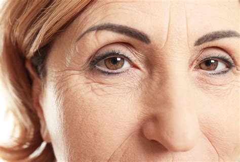 Home Remedies For Wrinkles Top 10 Home Remedies