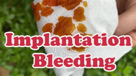 Implantation Bleeding Pregnancy ️ Heres Everything To Know About It Youtube