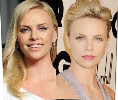 Charlize Theron Only Admits Dental Surgery Amid Plastic Surgery Rumors