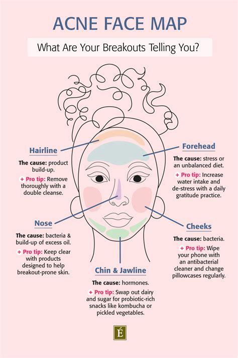 Acne Face Map What Are Your Breakouts Telling You Be Yourself Feel