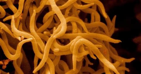 U jednej osoby na sto w miejscu ukłucia pojawia się niewielki, niebolesny naciek. Borelioza - Barbara Plucinska - choroba z LYME: krętki Borrelia - bakterie