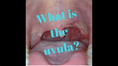 Uvula Anatomy