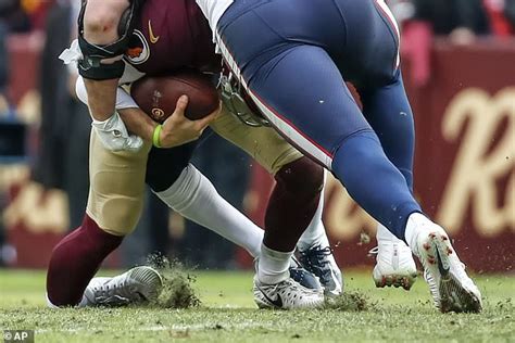 Much more severe in a health sense. NFL star Alex Smith suffers horrific broken leg in ...