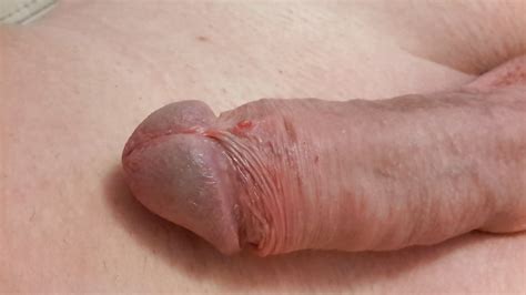 Uncircumcised Penis Frenulum Xxx Porn