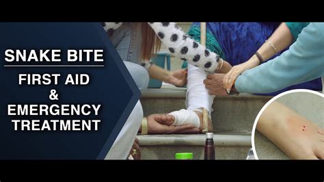 First Aid And Emergency Treatment Snake Bite English Youtube