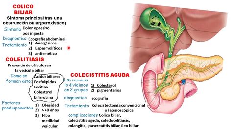 Colelitiasis Colecistitis Coledocolitiasis Colangitis Youtube