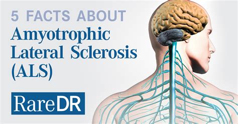 Five Facts About Amytrophic Lateral Sclerosis Als Infographic