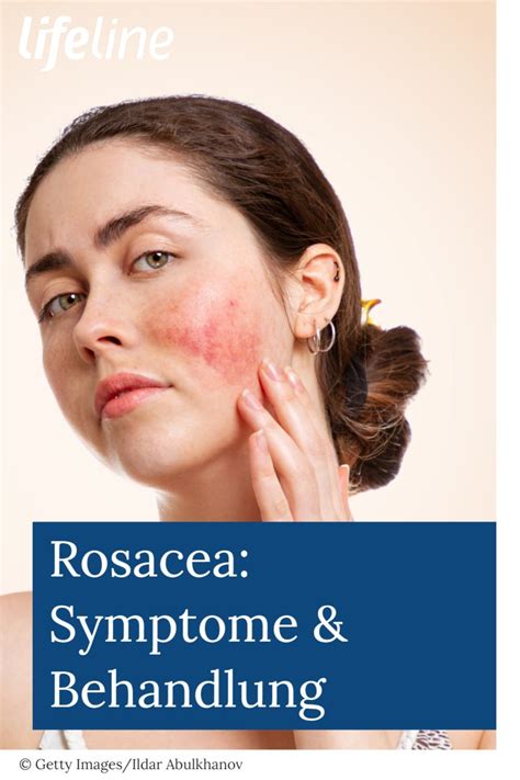 Rosacea Behandlung