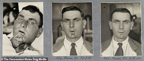 Facemaker Who Saved The Broken Gargoyles Of World War I The