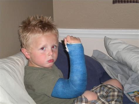 Bradys House The Broken Arm