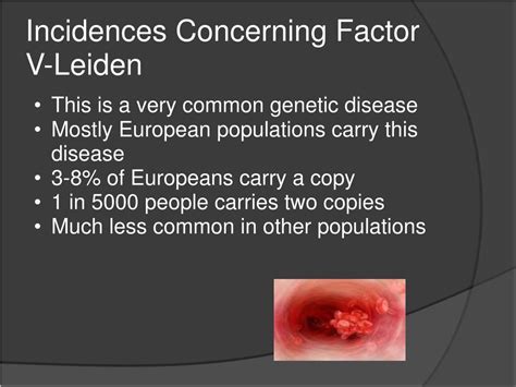 Ppt What Is Factor V Leiden Powerpoint Presentation Free Download