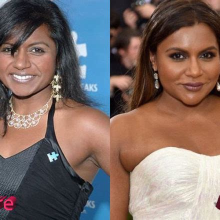 Mindy Kaling Plastic Surgery A Project Done Well