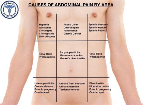 Differential Diagnosis Of Abdominal Pain By Area Abdominal Pain