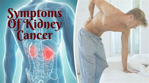 Symptoms Of Kidney Cancer Youtube