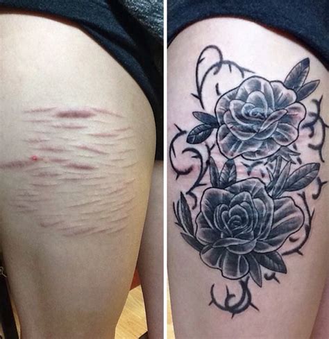 10 Amazing Tattoos That Turn Scars Into Works Of Art Tatuagens Amor