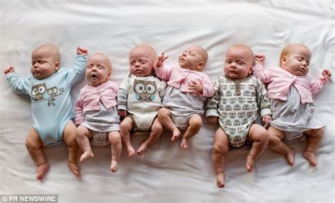 After one baby was born, staff rushed the newborn into another room and waited for the next, the hospital said. Sextuplets reunited in first photo together after last of ...
