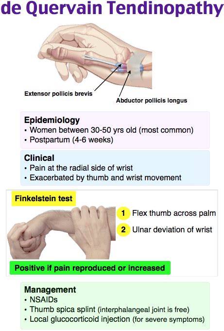 De Quervains Tendonitis