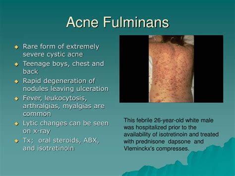 Ppt Acne Powerpoint Presentation Id148058