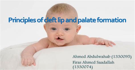 Principles Of Cleft Lip And Palate Formation Pdf Document