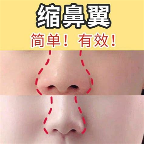 the nasal edges high bridge of the nose essence thin nasal essential oi beautiful nose essential