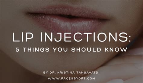 Lip Injections 5 Things You Should Know Dr Kristina Tansavatdi