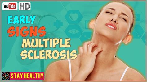 7 Early Signs Of Multiple Sclerosis You Should Know About Youtube