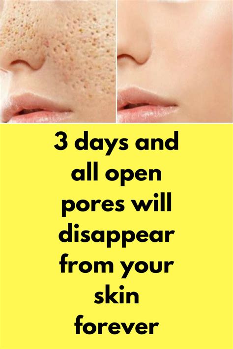 3 Days And All Open Pores Will Disappear From Your Skin Forever Skin