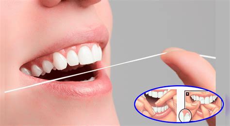 ¿Realmente sirve usar hilo dental para limpiar nuestros dientes? Lo que