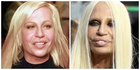 CONFESSORMISSY S BLOG Plastic Surgery Gone Awfully Wrong