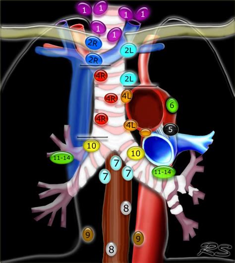 The Radiology Assistant Mediastinal Lymph Node Map 2023