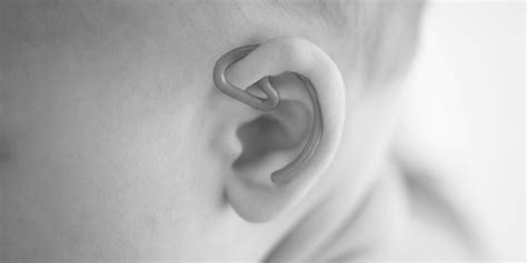 Neonatal Ear Splint Update — Ara Manawa