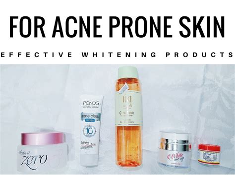 5 Guaranteed Effective Products For Acne Prone Skin Kikaysikat