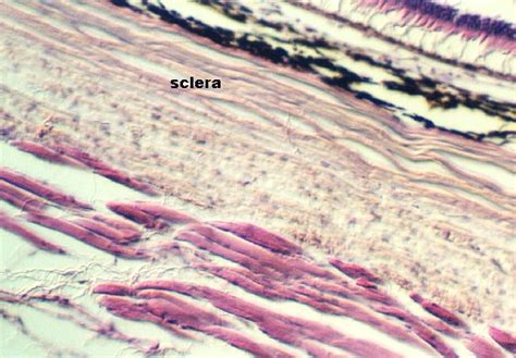Retina Sclera And Choroid Microanatomy Web Atlas Gwen V Childs