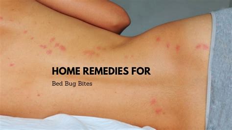 Bed bugs, or cimicidae, are small parasitic insects. Home Remedies for Bed Bug Bites - Bed Bugs Sprays