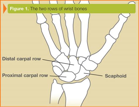 scaphoid fractures ocean orthopedic associates