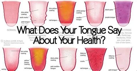 What Does Your Tongue Say About Your Health Healthy Holistic Living