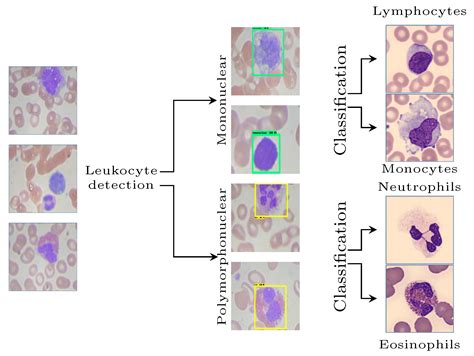 Diagnostics Free Full Text An Efficient Multi Level Convolutional