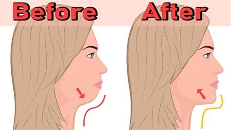 Face Exercises Easy Face Exercise For Double Chin Exercise Anshu