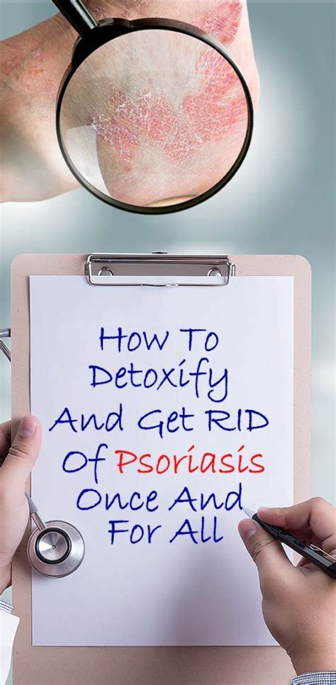 How To Detoxify And Get Rid Of Psoriasis Once And For All Psoriasis