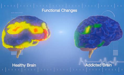 Brain Function Archives Most Effective Medical Clinic Anywhere