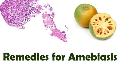 Use This 5 Effective Home Remedies For Amebiasis Youtube