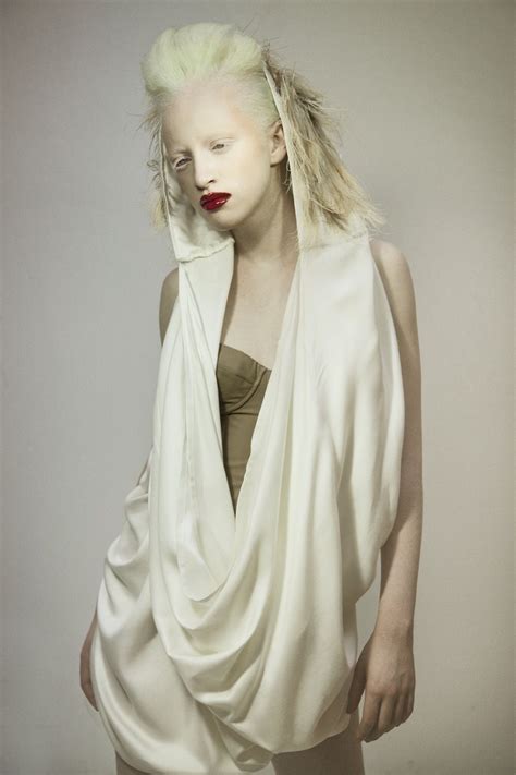 Model With Albinism Sheer Beauty