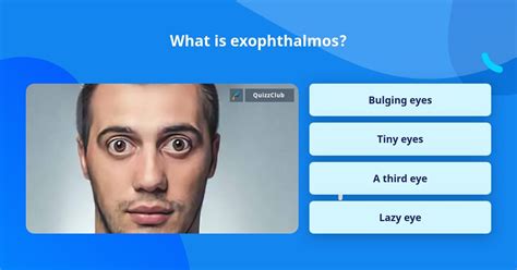 What Is Exophthalmos Trivia Questions Quizzclub