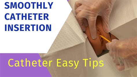 How To Insert Foley Catheter Without Ureathral Injury Catheter