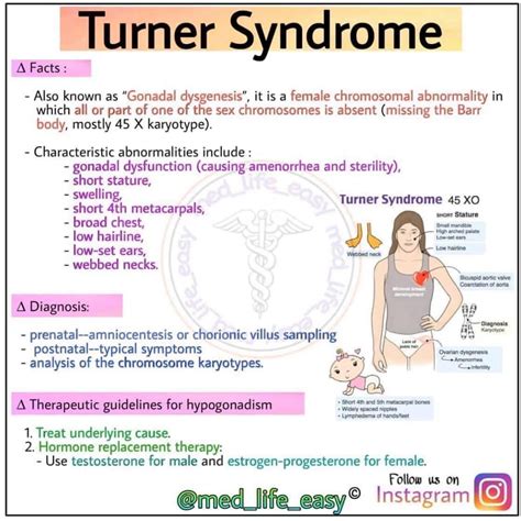 Turner Syndrome MEDizzy