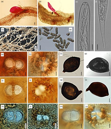 The Infection Process And General Morphology Of Cereal Cyst Nematodes