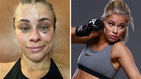 Paige Vanzant Bkfc Debut Injuries After Britain Hart Fight Result Bkfc Knucklemania Nt News