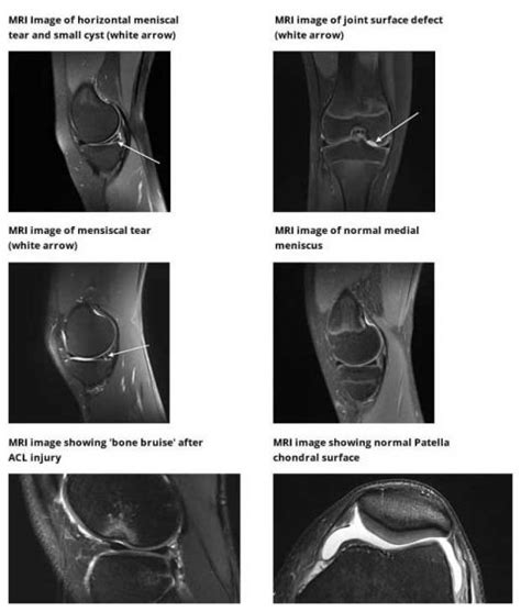 Knee Examinations Diagnosis And Imaging Yorkshire Knee Clinic