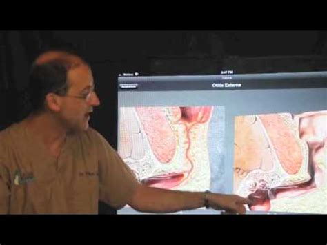 What you need to know. Total ear canal ablation (TECA) in the dog and cat. - YouTube